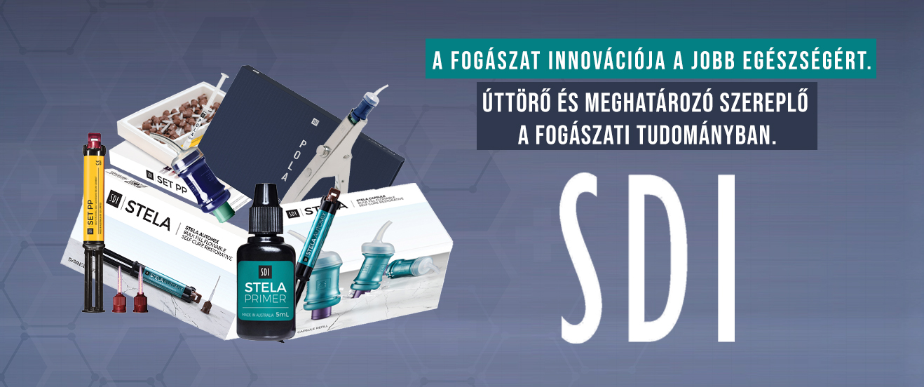sdi