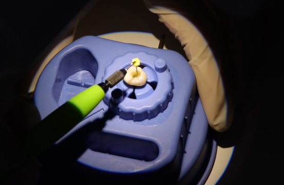 Microscope file handle 3